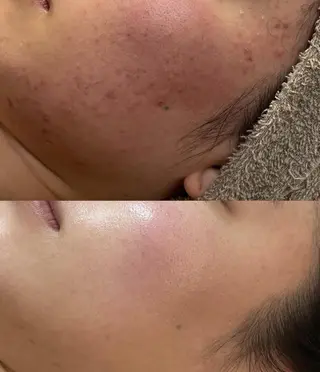 OPREA 千種店のエステ・リラクイメージ