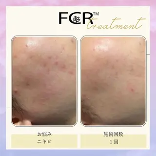 肌質改善Charme coco 増毛のエステ・リラクイメージ