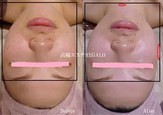 REGALO所属・矢野 さやかのエステ・リラクイメージ