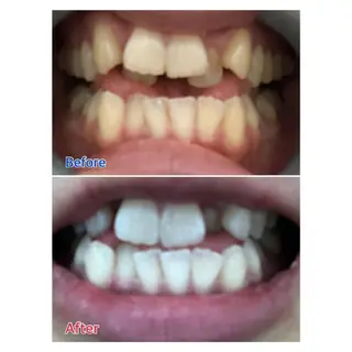 MBEAUTYSALON 千葉店・京成大久保所属・Melty 輝のその他イメージ