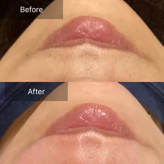 産毛専門店 Bittoのエステ・リラクイメージ