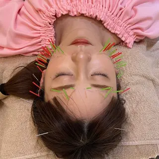 THE  ROOTS所属・美容鍼♡小顔矯正♡ fumikaのエステ・リラクイメージ