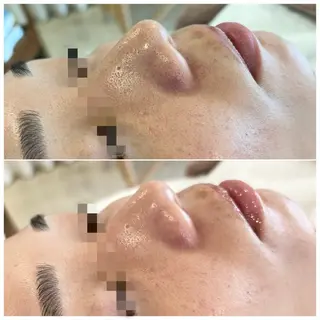 ebcs 8のエステ・リラクイメージ