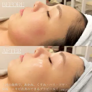 癒し&美活サロン COALALU麻布の眉毛・アイブロウイメージ