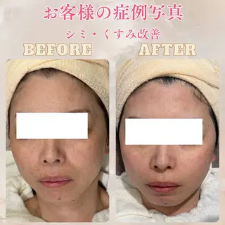 pansy(パンジー)上野フェイシャルエステ専門店所属・pansy saraのエステ・リラクイメージ