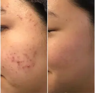 ROUN'　南 鈴沙のネイルデザイン