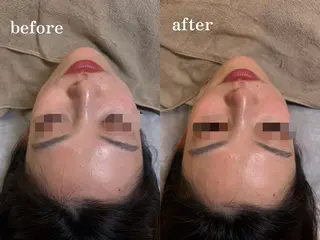 ENNE Lash&Blow by&ERA所属・ENNE🦩小顔整体 師🌿 HINAKOのエステ・リラクイメージ