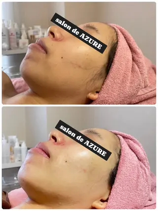 春日井/脱毛・エステサロン salon de AZURE所属・salon de AZUREのエステ・リラクイメージ