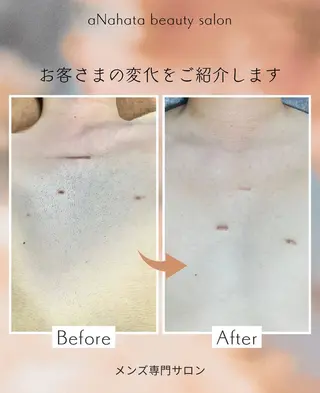 メンズ aNahata beauty salon所属・田中 菜月のエステ・リラクイメージ