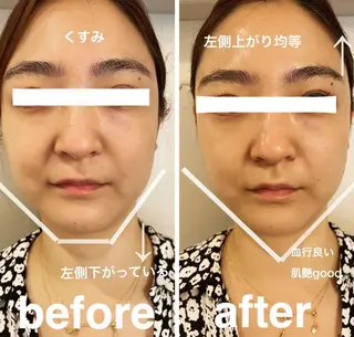 美容鍼灸サロン mahoroba院長のエステ・リラクイメージ