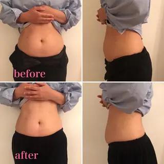 美腸リンパサロン Le Lienのエステ・リラクイメージ