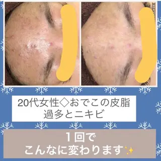 ショート パーマ ヘアアレンジ メンズ キッズ ネイル マツエク・マツパ ニキビ・肌質改善専門 ♡人生が変わるサロンのエステ・リラクイメージ