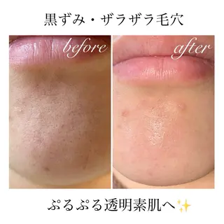 ダイエット・美肌ケア fleurのエステ・リラクイメージ