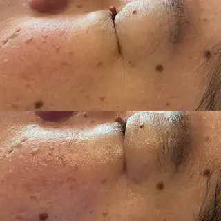 メナードフェイシャルサロン　リンガーデン所属・山口 郁代のエステ・リラクイメージ