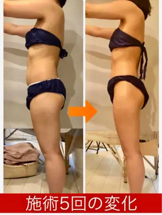 ショート カラー パーマ ヘアアレンジ メンズ キッズ ネイル マツエク・マツパ ‍痩身＆ボディ 結果出し🌟丹野のエステ・リラクイメージ