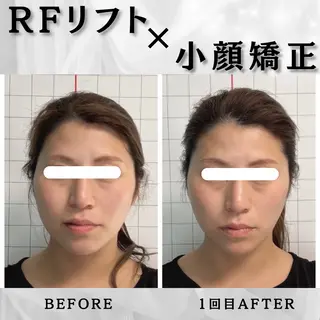 小顔矯正専門店 【RED】池田のエステ・リラクイメージ