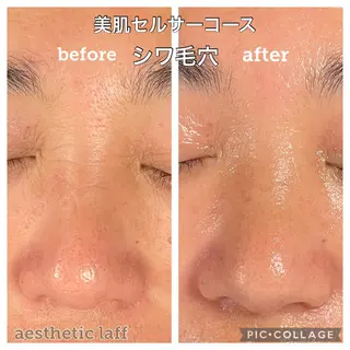 aesthetic laff所属・美肌作りのサロン 山村亜美のエステ・リラクイメージ