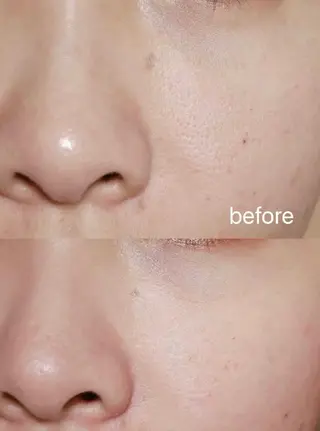 マツエク・マツパ aliaハイフ&水光ジェットサロン所属・aliaハーブ水光店 エステティシャン募集のエステ・リラクイメージ