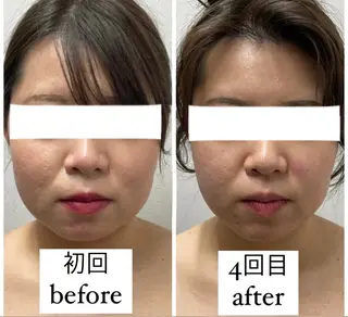 ENCHANT 脱毛.小顔.毛穴のエステ・リラクイメージ