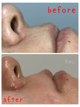 シュガーリング/脱毛 EARLS三軒茶屋のエステ・リラクイメージ