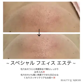 マツエク・マツパ ビューティー ミロワールのエステ・リラクイメージ