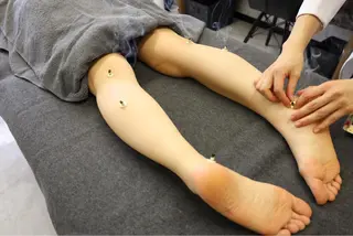 ニキビ特化美容鍼 ×ハーブピーリングのエステ・リラクイメージ