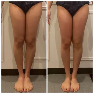 ハイパーナイフEX 小顔×痩身ケアのエステ・リラクイメージ