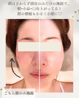 小顔リフトアップ専門 サロン／ダリア 大分のエステ・リラクイメージ