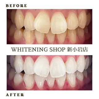 メンズ ホワイトニング ショップ新小岩店のその他イメージ