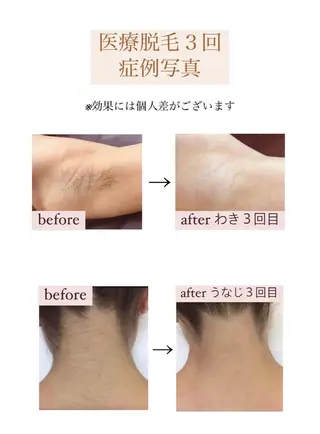 BITSU　PRESS原宿所属・PRESS 中山のエステ・リラクイメージ