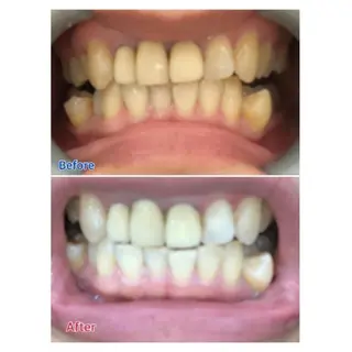 M渋谷店所属・M渋谷 ホワイトニングのエステ・リラクイメージ