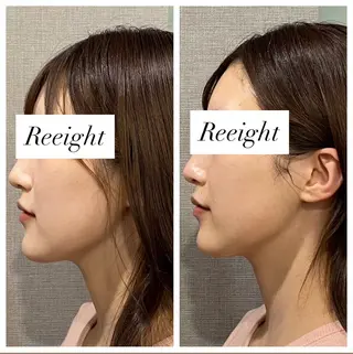 肌質改善専門 ハーブ /毛穴洗浄 リエイトのエステ・リラクイメージ