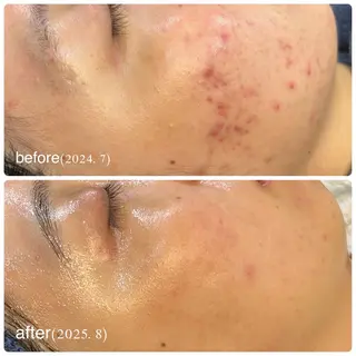 leolo武蔵浦和 肌質改善＆脱毛のエステ・リラクイメージ