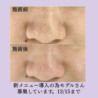 Callana所属・Callana KAYOのエステ・リラクイメージ