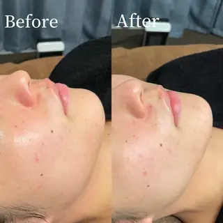 LTIENA新宿🌷 maiのエステ・リラクイメージ