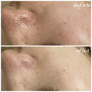 メンズ メナード岐阜茜部 杉浦のエステ・リラクイメージ