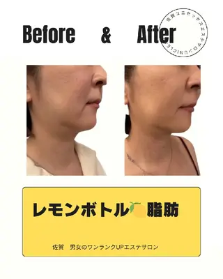 ユニセックスエステサロンUniclear所属・痩身&フェイシャル Uniclearのエステ・リラクイメージ