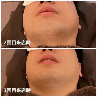 メンズ メンズ脱毛ECXIA所属・men's脱毛サロン ECXIAのエステ・リラクイメージ