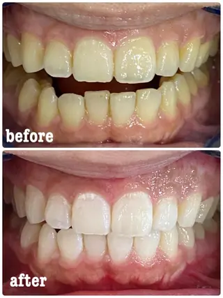 ホワイトニングサロン ラウレアのその他イメージ