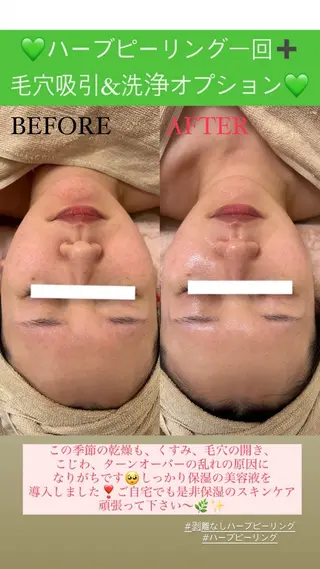 メンズ Salon de Lino 御器所のエステ・リラクイメージ