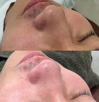 Moana【モアナ】 KARIN🫧のエステ・リラクイメージ