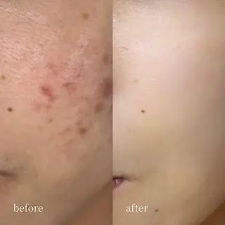 韓国肌管理・肌質改善 EARNEST心斎橋のエステ・リラクイメージ