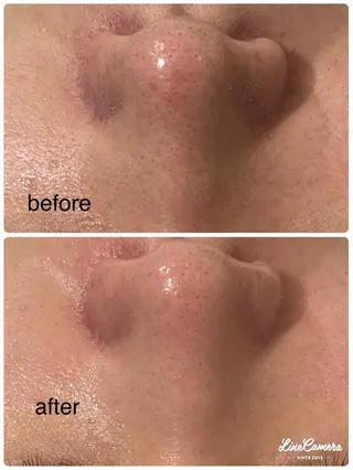 De I'm 名古屋栄店所属・原 いず美のエステ・リラクイメージ