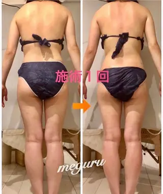 ショート カラー パーマ ヘアアレンジ メンズ キッズ ネイル マツエク・マツパ ‍痩身＆ボディ 結果出し🌟丹野のエステ・リラクイメージ