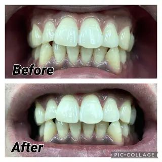 セルフホワイトニングCOCOSHIRO所属・セルフホワイトニング COCOSHIROのエステ・リラクイメージ