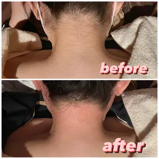 脱毛＆エステサロン JIGGLY☆松田のエステ・リラクイメージ