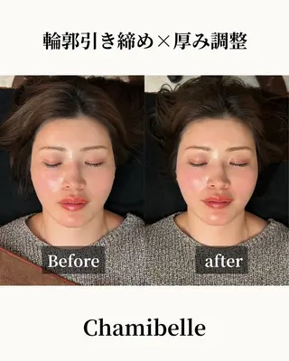 美容鍼灸サロン Chamibelleのエステ・リラクイメージ