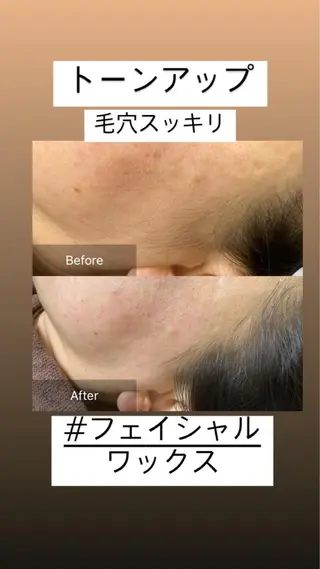 産毛専門店 Bittoのエステ・リラクイメージ