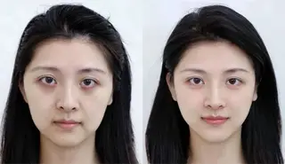 マツエク・マツパ aliaハイフ&水光ジェットサロン所属・aliaハーブ水光店 エステティシャン募集のエステ・リラクイメージ