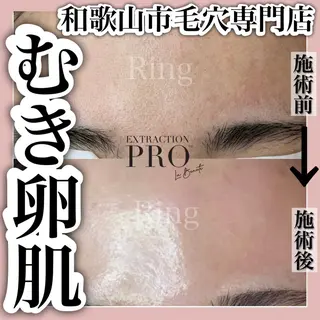 和歌山　毛穴専門店 Ringのエステ・リラクイメージ